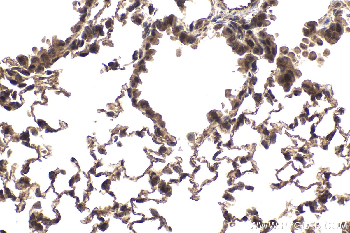 Immunohistochemical analysis of paraffin-embedded mouse lung tissue slide using KHC1660 (IRF9 IHC Kit).