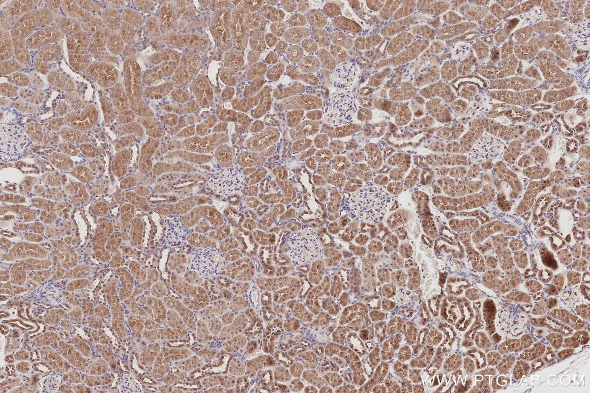 Immunohistochemical analysis of paraffin-embedded rat kidney tissue slide using KHC3049 (IRSp53 IHC Kit). Immunohistochemical analysis of paraffin-embedded rat kidney tissue slide using KHC3049 (IRSp53 IHC Kit).