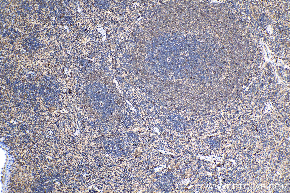 Immunohistochemical analysis of paraffin-embedded rat spleen tissue slide using KHC1342 (ISG20 IHC Kit).