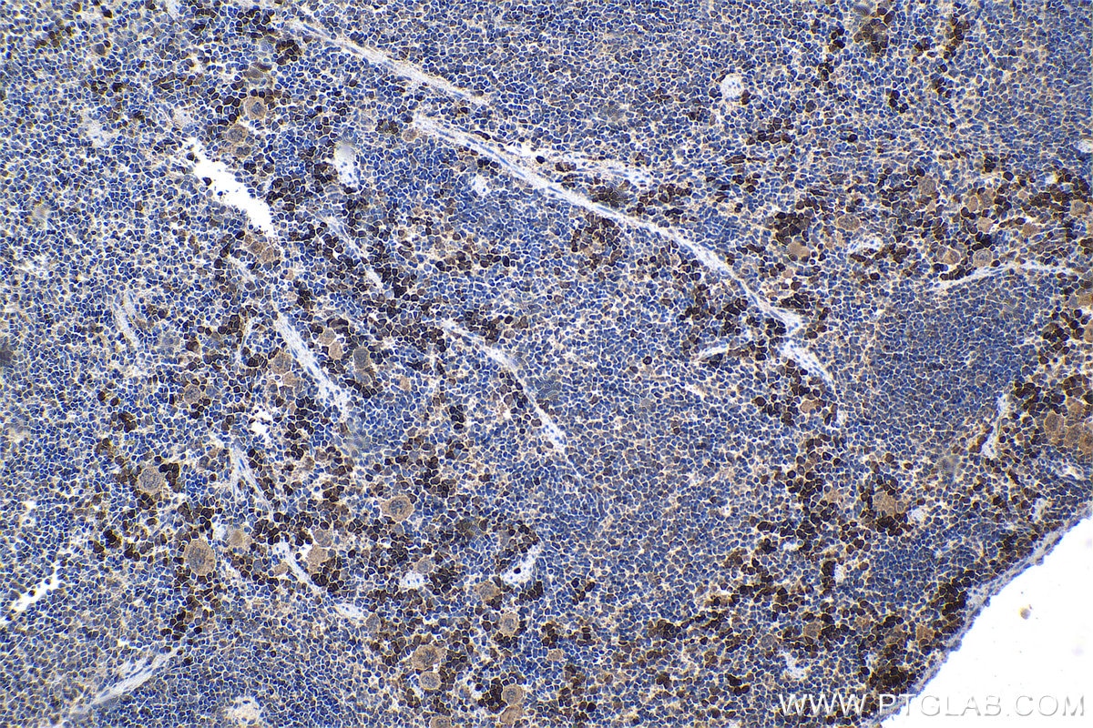 Immunohistochemical analysis of paraffin-embedded mouse spleen tissue slide using KHC1342 (ISG20 IHC Kit).