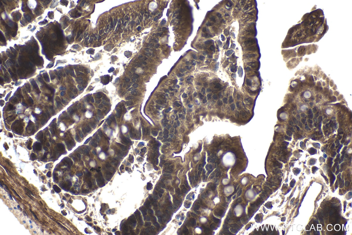 Immunohistochemical analysis of paraffin-embedded mouse small intestine tissue slide using KHC1875 (ITCH IHC Kit).