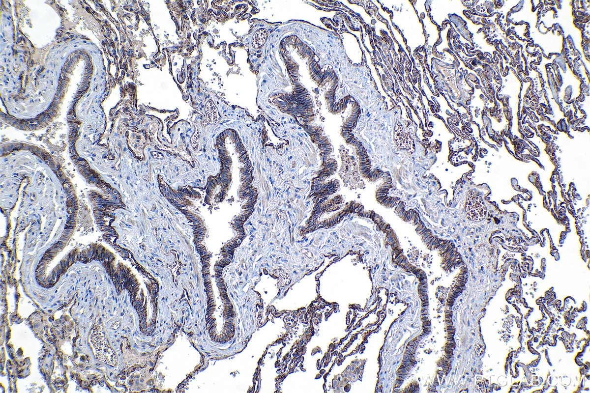 Immunohistochemical analysis of paraffin-embedded human lung tissue slide using KHC1334 (ITGA3 IHC Kit).