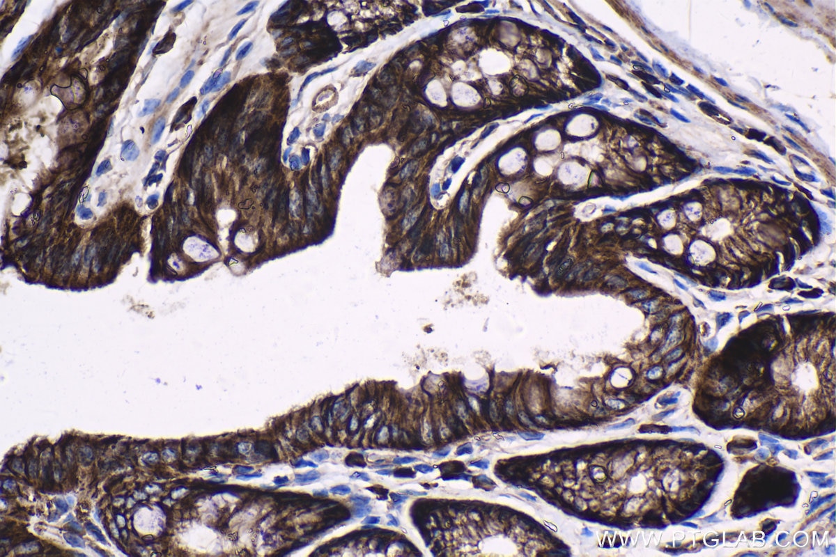 Immunohistochemical analysis of paraffin-embedded mouse colon tissue slide using KHC1334 (ITGA3 IHC Kit).