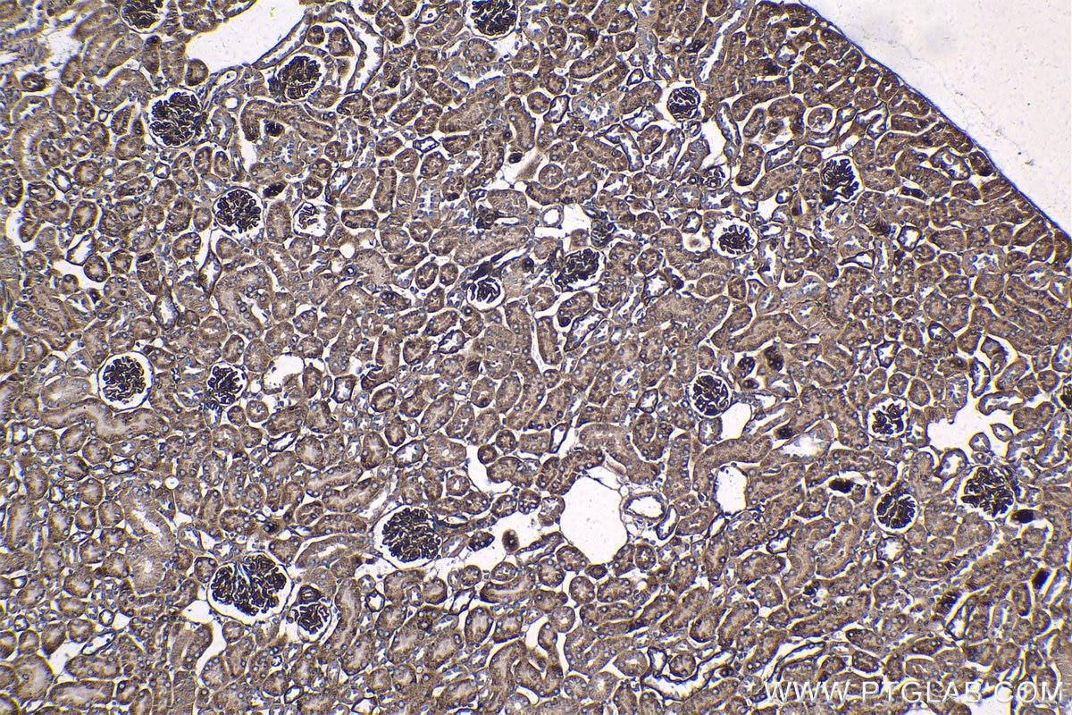 Immunohistochemical analysis of paraffin-embedded mouse kidney tissue slide using KHC1334 (ITGA3 IHC Kit).