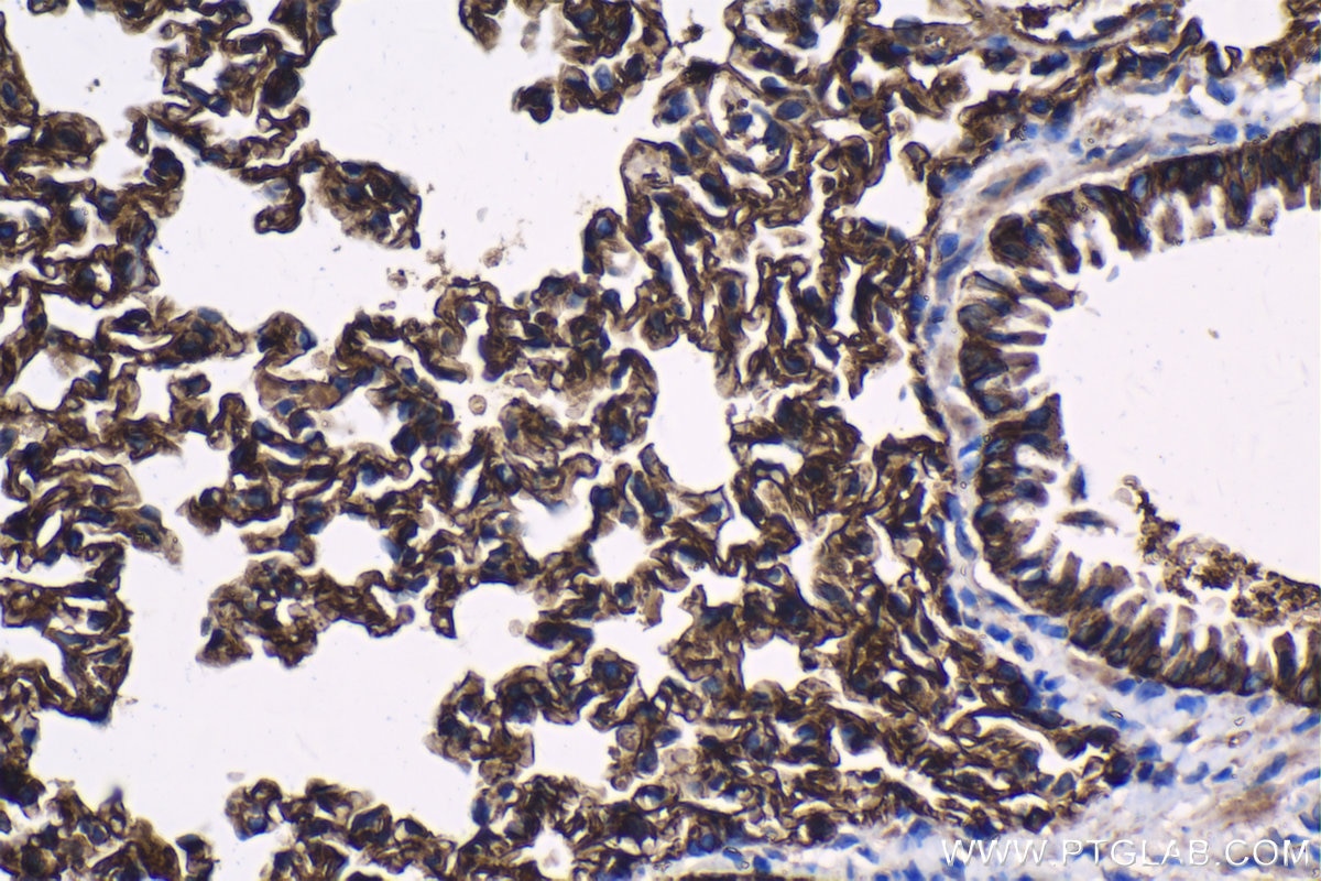 Immunohistochemical analysis of paraffin-embedded mouse lung tissue slide using KHC1334 (ITGA3 IHC Kit).