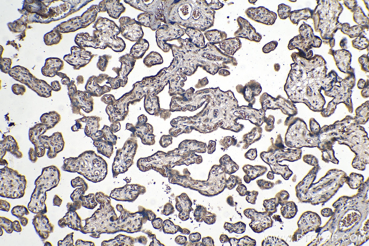 Immunohistochemical analysis of paraffin-embedded human placenta tissue slide using KHC1335 (ITGB3/CD61 IHC Kit).