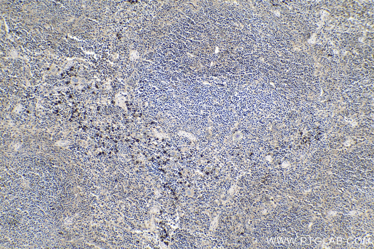 Immunohistochemical analysis of paraffin-embedded mouse spleen tissue slide using KHC1335 (ITGB3/CD61 IHC Kit).