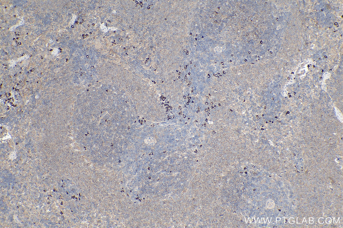 Immunohistochemical analysis of paraffin-embedded rat spleen tissue slide using KHC1335 (ITGB3/CD61 IHC Kit).