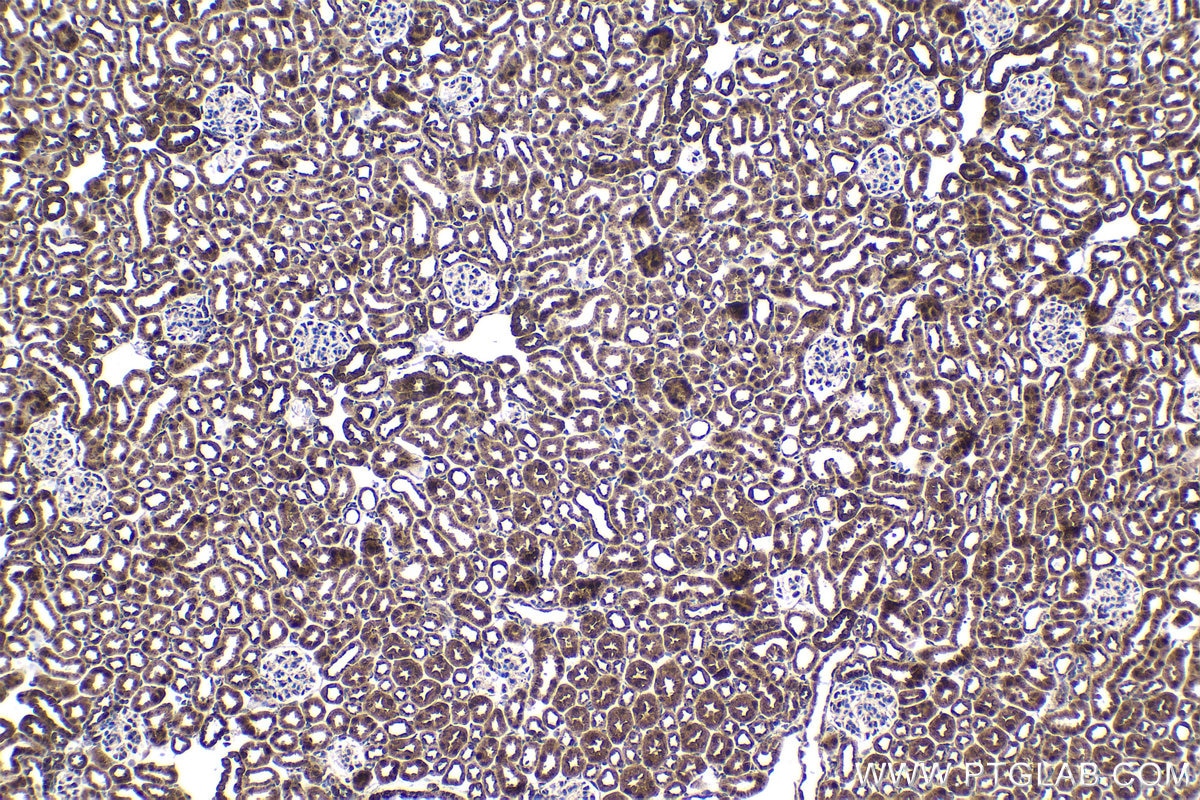 Immunohistochemical analysis of paraffin-embedded mouse kidney tissue slide using KHC1711 (ITGB3BP IHC Kit).
