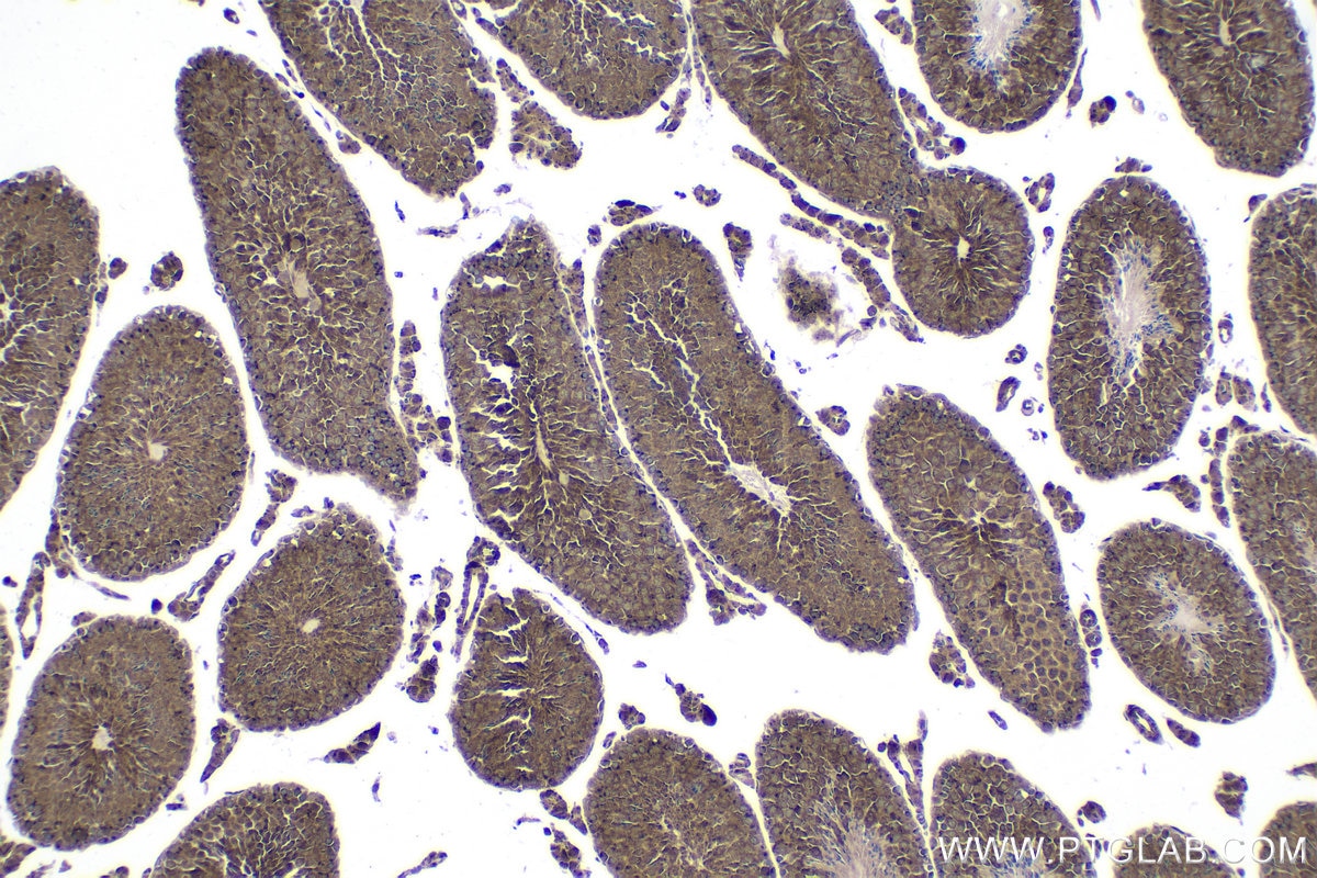 Immunohistochemical analysis of paraffin-embedded mouse testis tissue slide using KHC1711 (ITGB3BP IHC Kit).