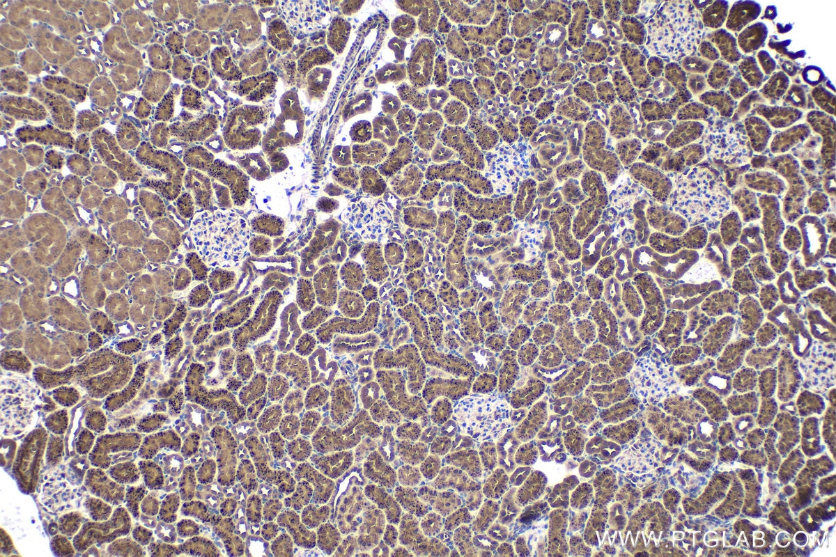 Immunohistochemical analysis of paraffin-embedded rat kidney tissue slide using KHC1711 (ITGB3BP IHC Kit).