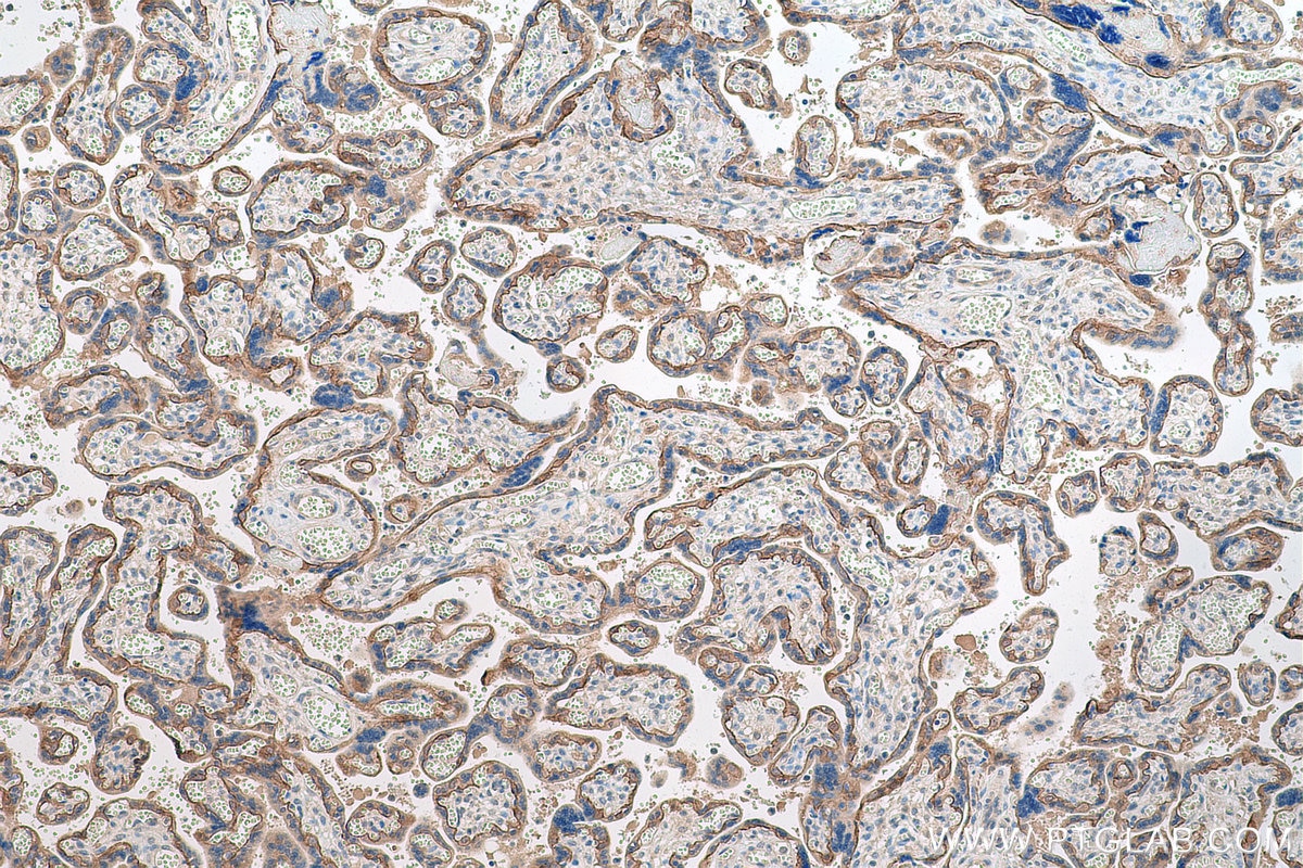 Immunohistochemical analysis of paraffin-embedded human placenta tissue slide using KHC0800 (ITGB4 IHC Kit).