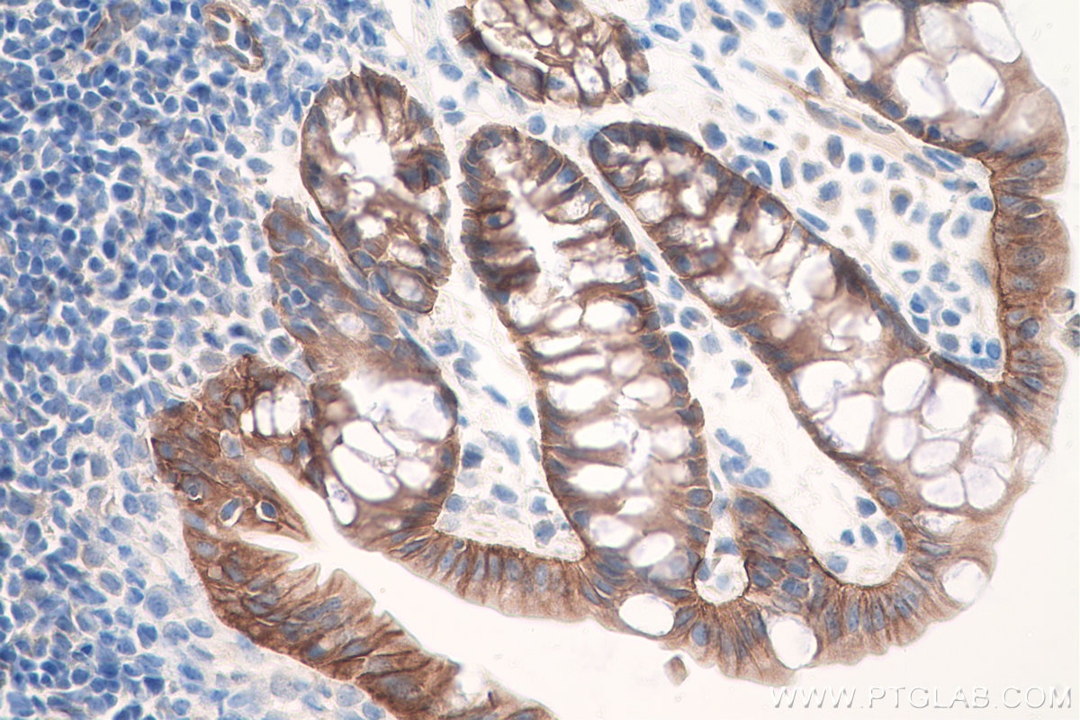 Immunohistochemical analysis of paraffin-embedded mouse colon tissue slide using KHC0800 (ITGB4 IHC Kit).