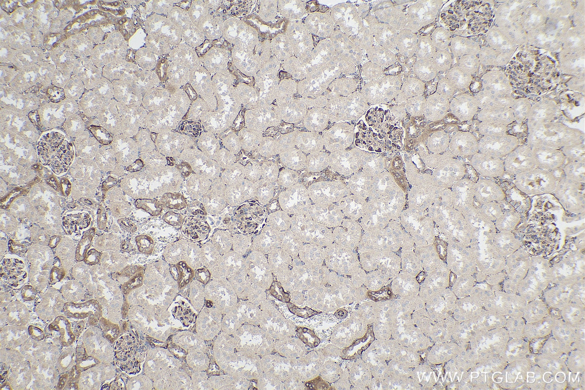 Immunohistochemical analysis of paraffin-embedded rat kidney tissue slide using KHC0221 (Integrin Beta 6 IHC Kit).