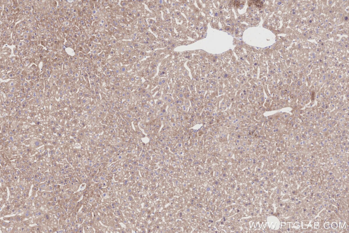 Immunohistochemical analysis of paraffin-embedded mouse liver tissue slide using KHC3196 (ITIH1 IHC Kit). Immunohistochemical analysis of paraffin-embedded mouse liver tissue slide using KHC3196 (ITIH1 IHC Kit).