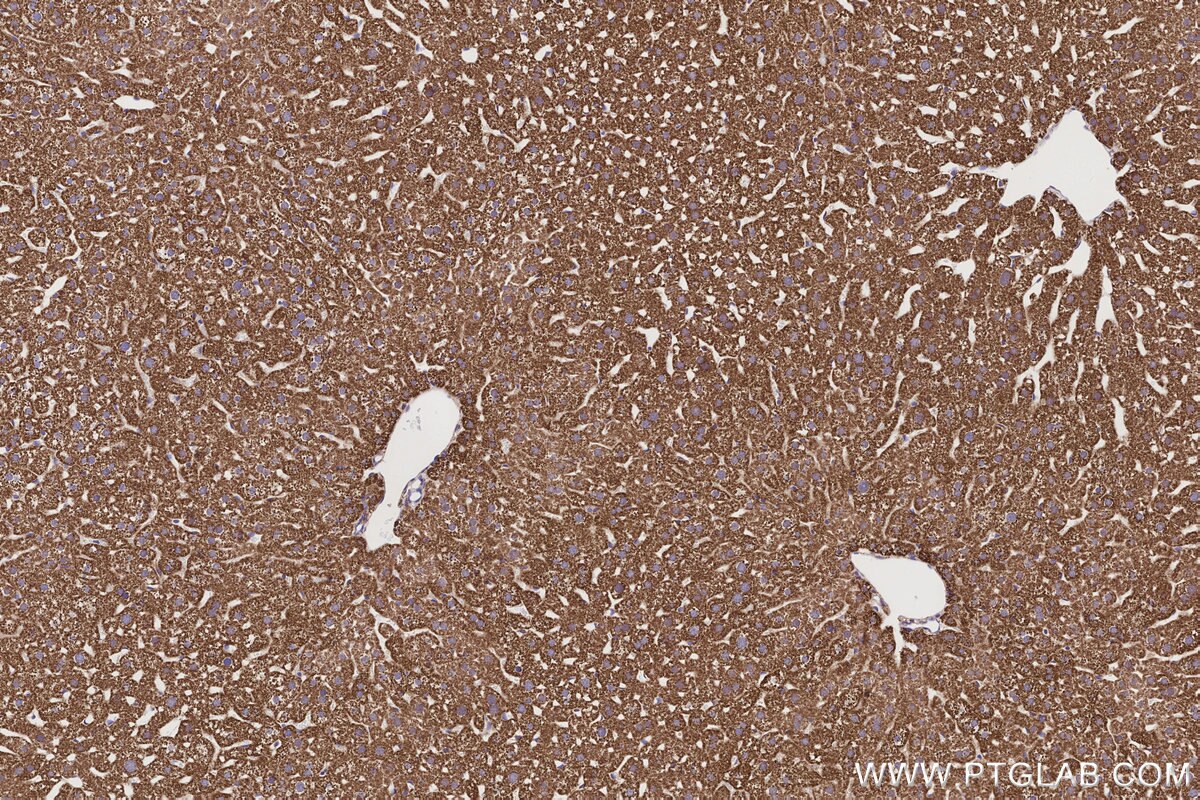 Immunohistochemical analysis of paraffin-embedded mouse liver tissue slide using KHC3202 (IVD IHC Kit). Immunohistochemical analysis of paraffin-embedded mouse liver tissue slide using KHC3202 (IVD IHC Kit).