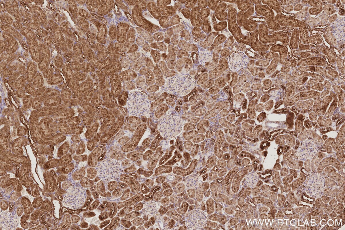 Immunohistochemical analysis of paraffin-embedded rat kidney tissue slide using KHC3096 (IVNS1ABP IHC Kit). Immunohistochemical analysis of paraffin-embedded rat kidney tissue slide using KHC3096 (IVNS1ABP IHC Kit).