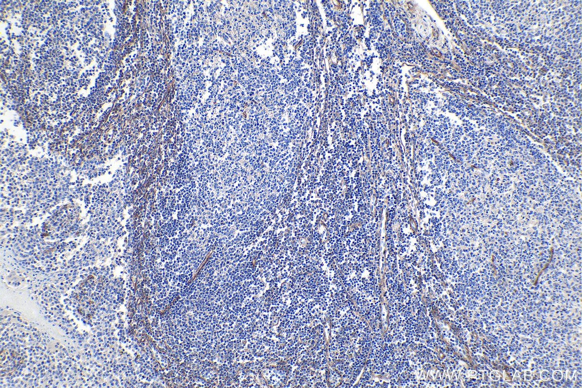 Immunohistochemical analysis of paraffin-embedded human tonsillitis tissue slide using KHC0111 (Integrin alpha-1 IHC Kit).