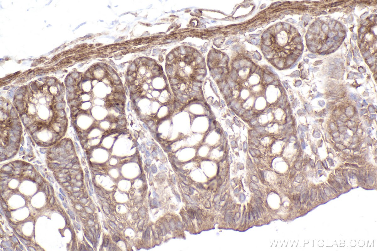 Immunohistochemical analysis of paraffin-embedded rat colon tissue slide using KHC2498 (Intersectin 1/ITSN1 IHC Kit).