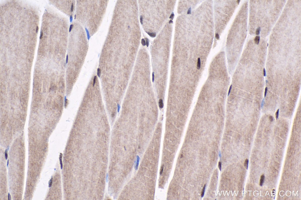 Immunohistochemical analysis of paraffin-embedded mouse skeletal muscle tissue slide using KHC1788 (JMJD6 IHC Kit).