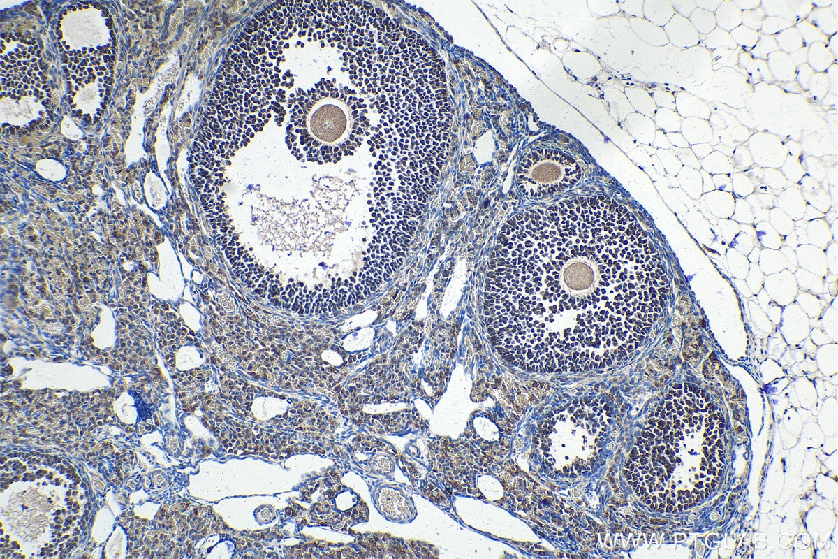 Immunohistochemical analysis of paraffin-embedded mouse ovary tissue slide using KHC1517 (JMJD7 IHC Kit).