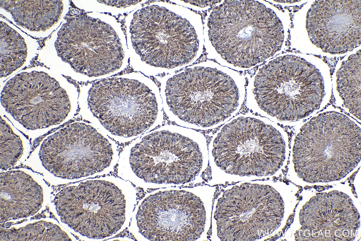 Immunohistochemical analysis of paraffin-embedded rat testis tissue slide using KHC1267 (JMY IHC Kit).