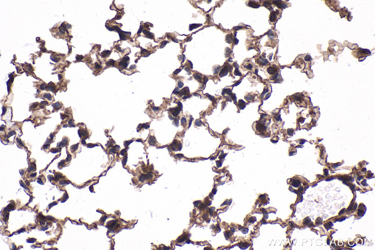 Immunohistochemical analysis of paraffin-embedded mouse lung tissue slide using KHC1734 (KANK1 IHC Kit).