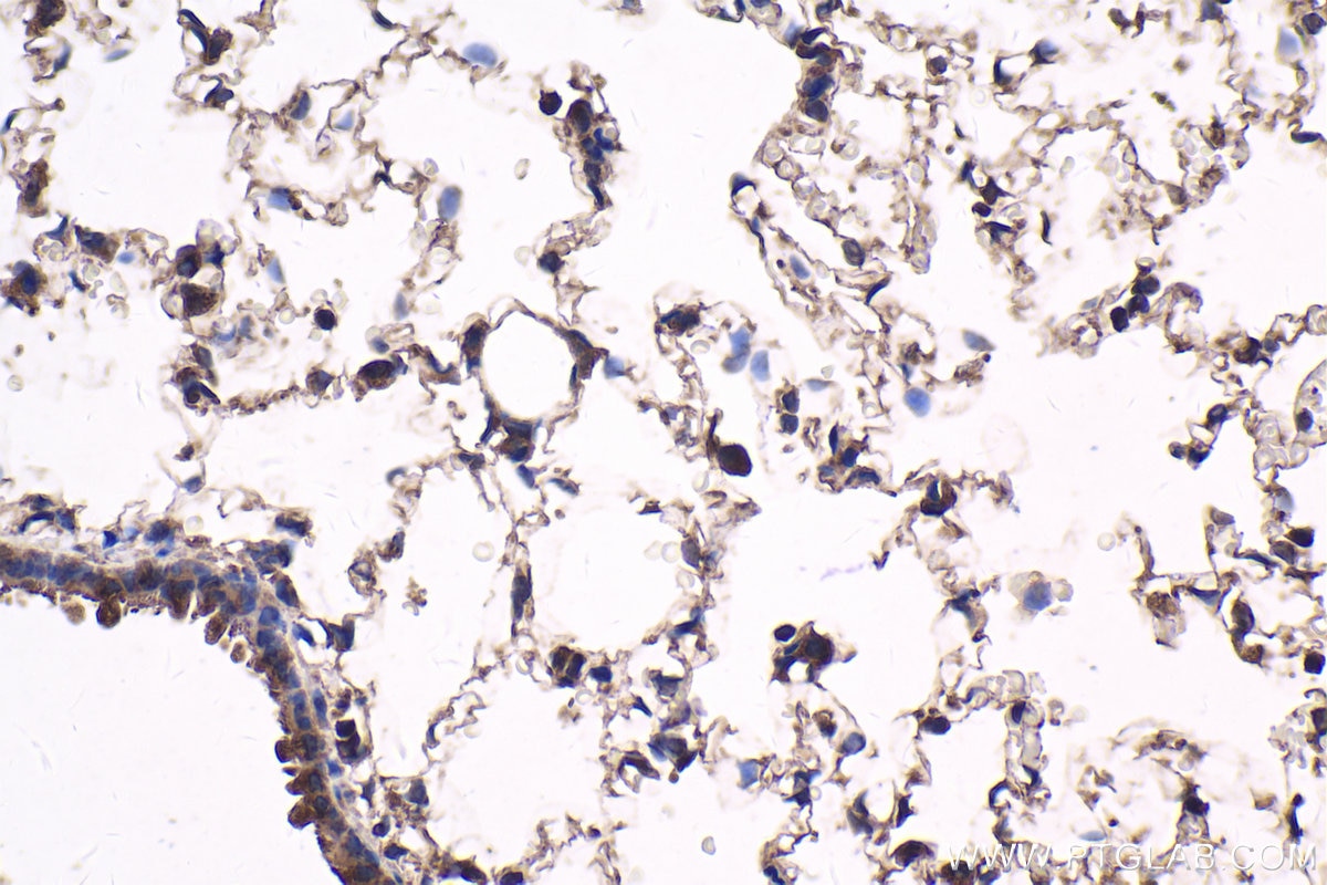 Immunohistochemical analysis of paraffin-embedded rat lung tissue slide using KHC1734 (KANK1 IHC Kit).