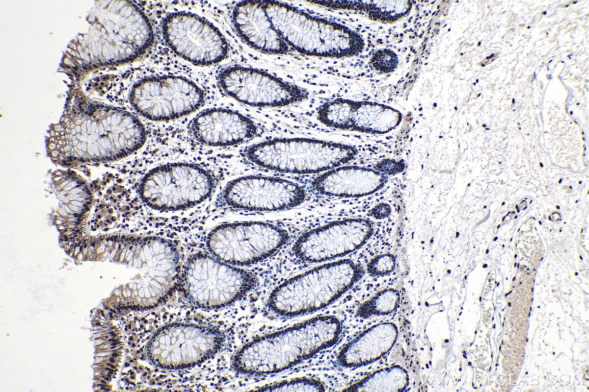 Immunohistochemical analysis of paraffin-embedded human colon tissue slide using KHC1178 (KAP1 IHC Kit).