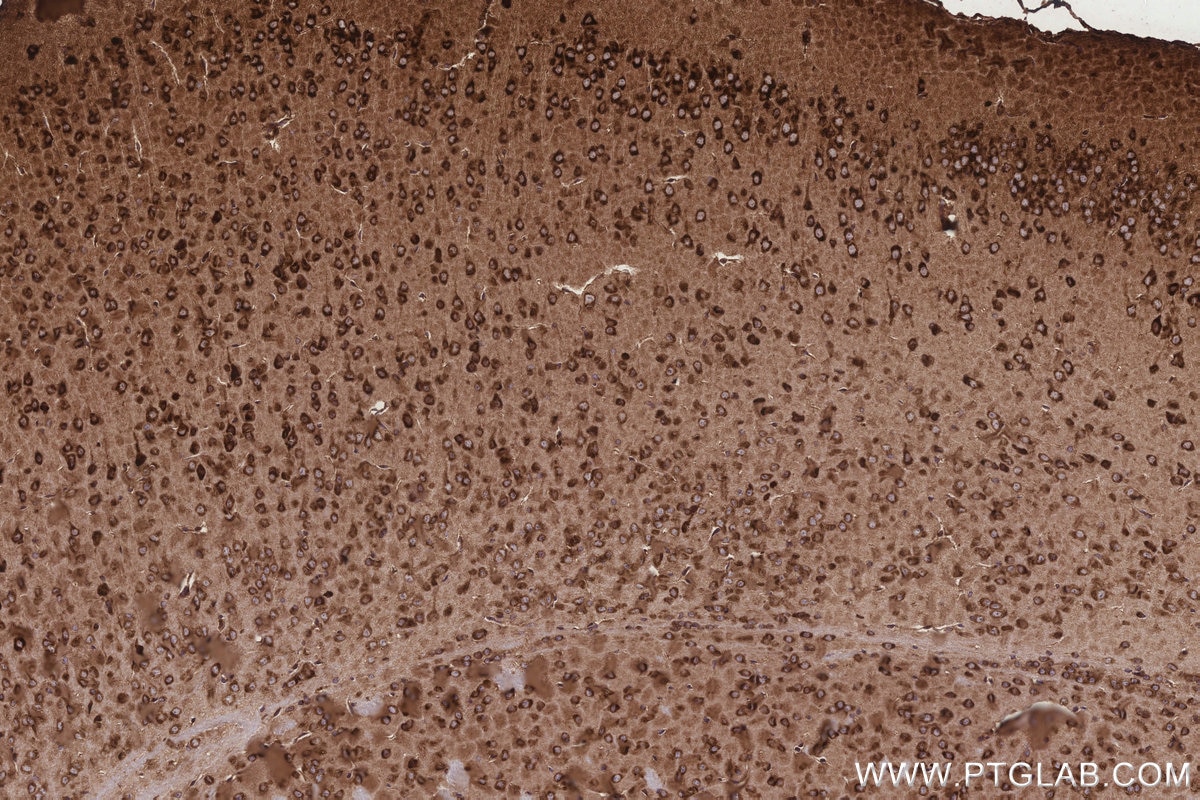 Immunohistochemical analysis of paraffin-embedded mouse brain tissue slide using KHC3255 (KARS IHC Kit).
