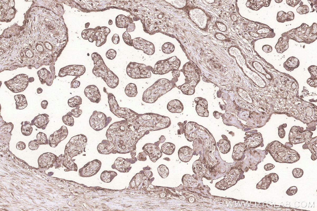 Immunohistochemical analysis of paraffin-embedded human placenta tissue slide using KHC3255 (KARS IHC Kit).