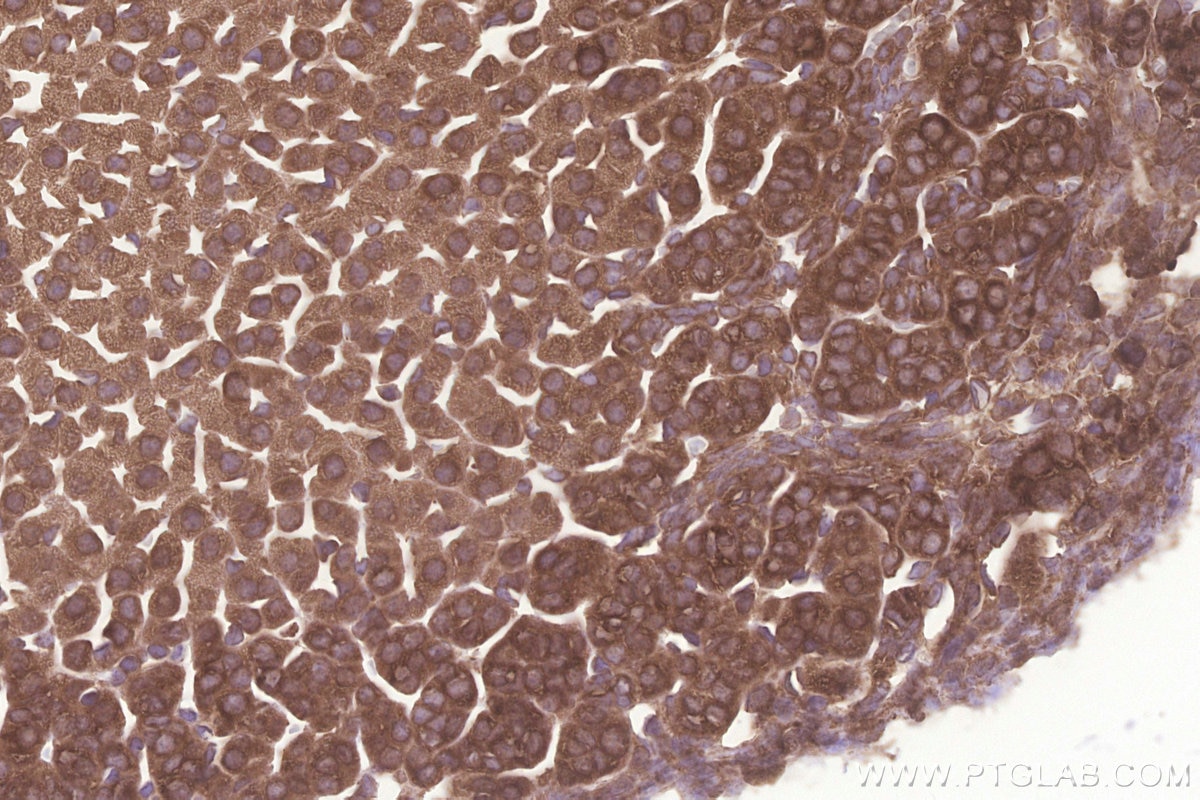Immunohistochemical analysis of paraffin-embedded mouse adrenal gland tissue slide using KHC3255 (KARS IHC Kit).