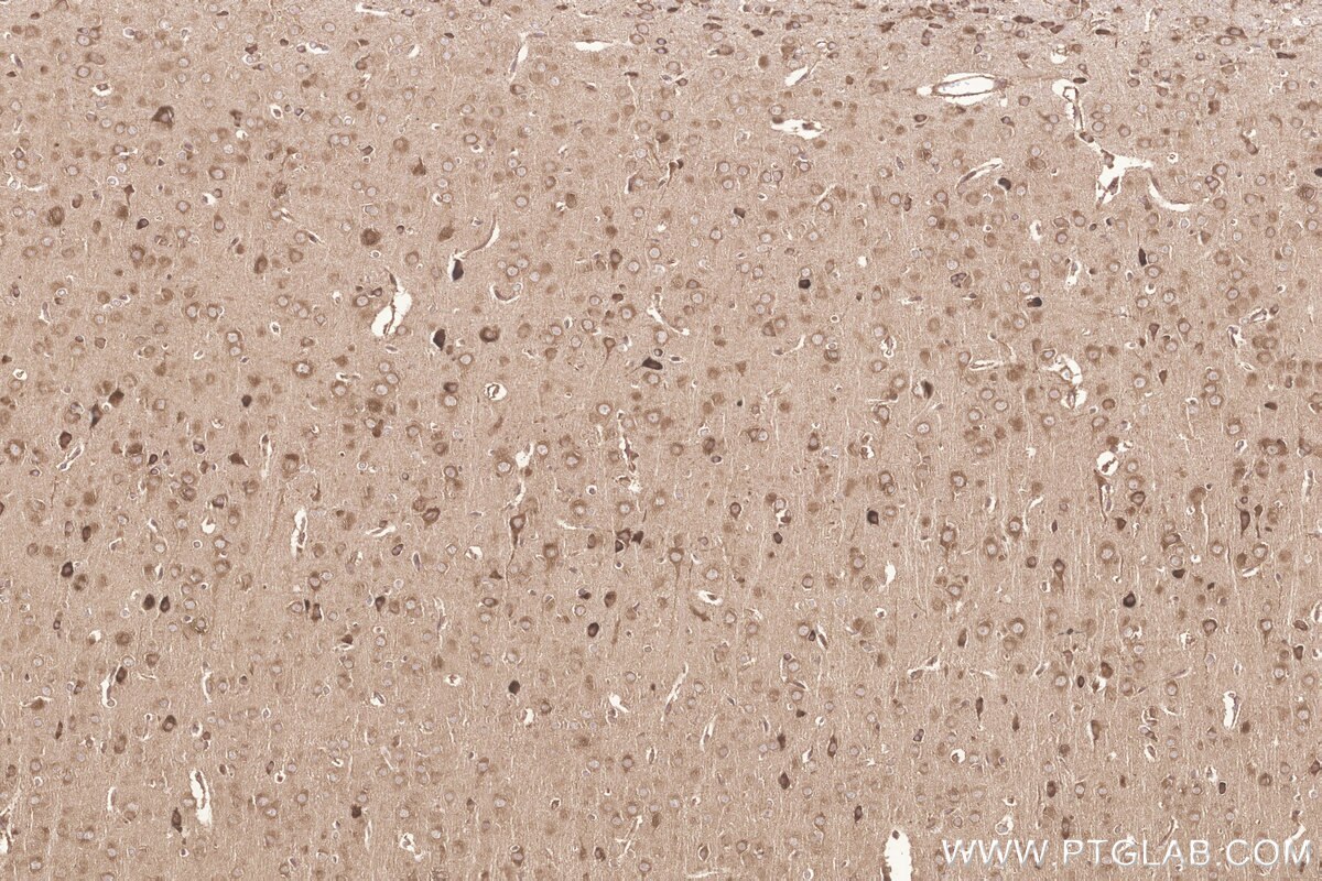 Immunohistochemical analysis of paraffin-embedded rat brain tissue slide using KHC3255 (KARS IHC Kit).