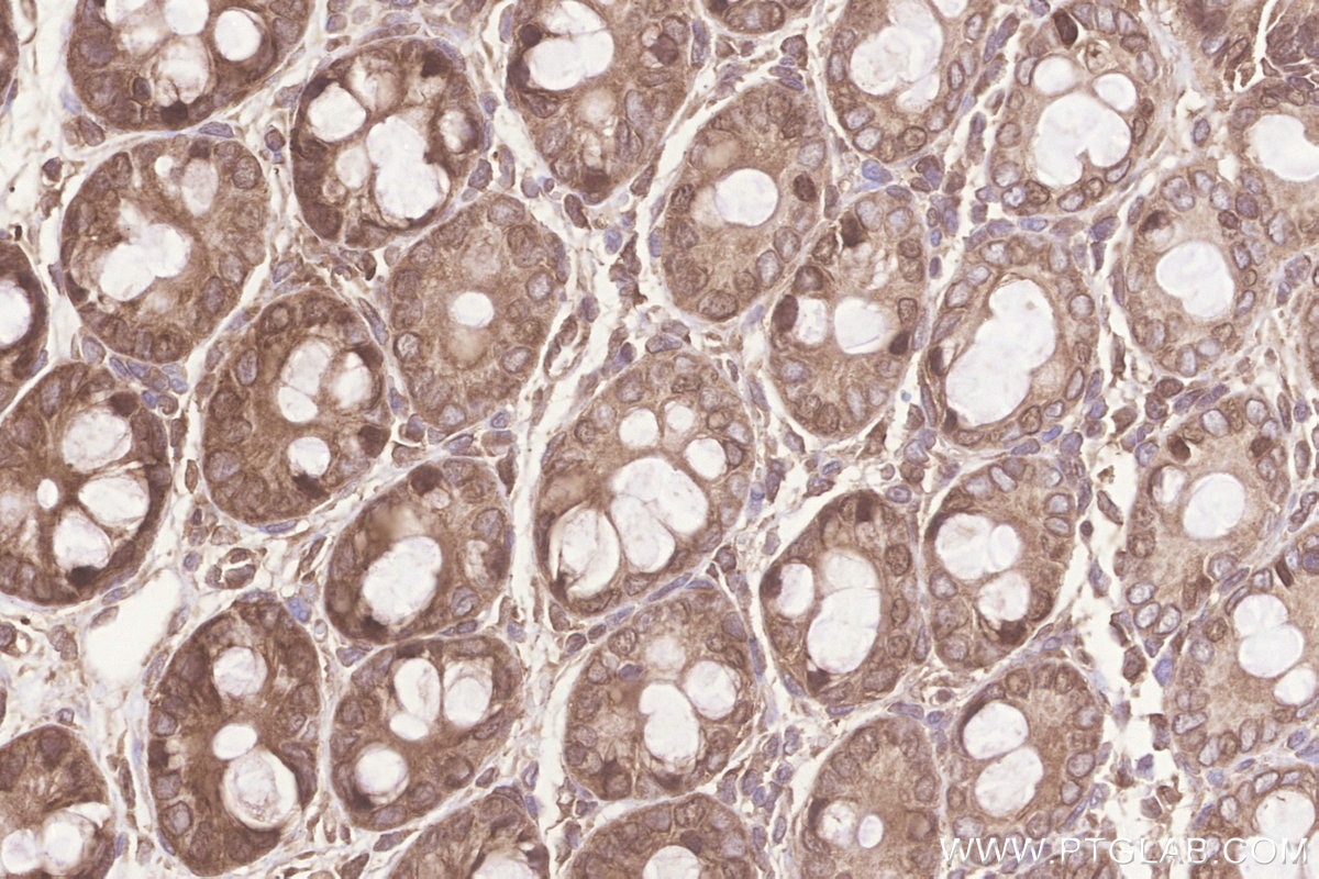Immunohistochemical analysis of paraffin-embedded rat colon tissue slide using KHC3255 (KARS IHC Kit).