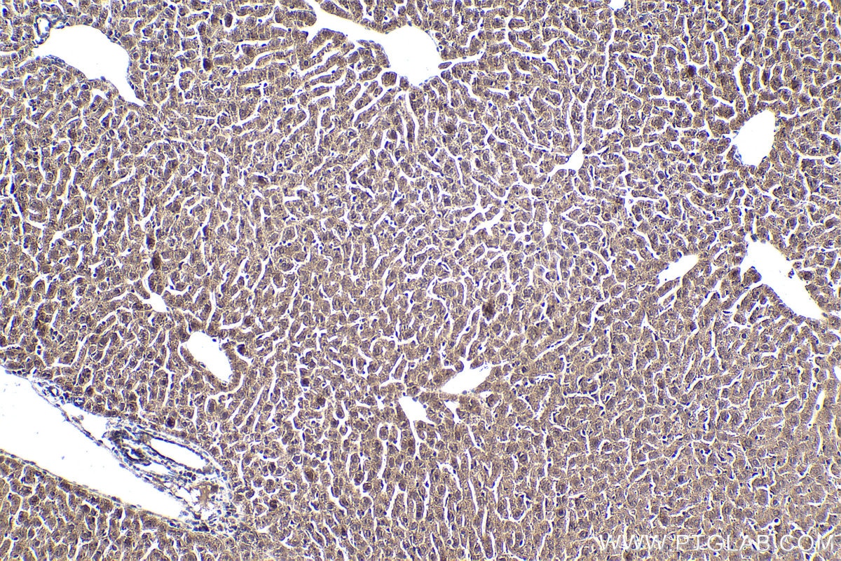 Immunohistochemical analysis of paraffin-embedded mouse liver tissue slide using KHC1862 (KAT5 IHC Kit).