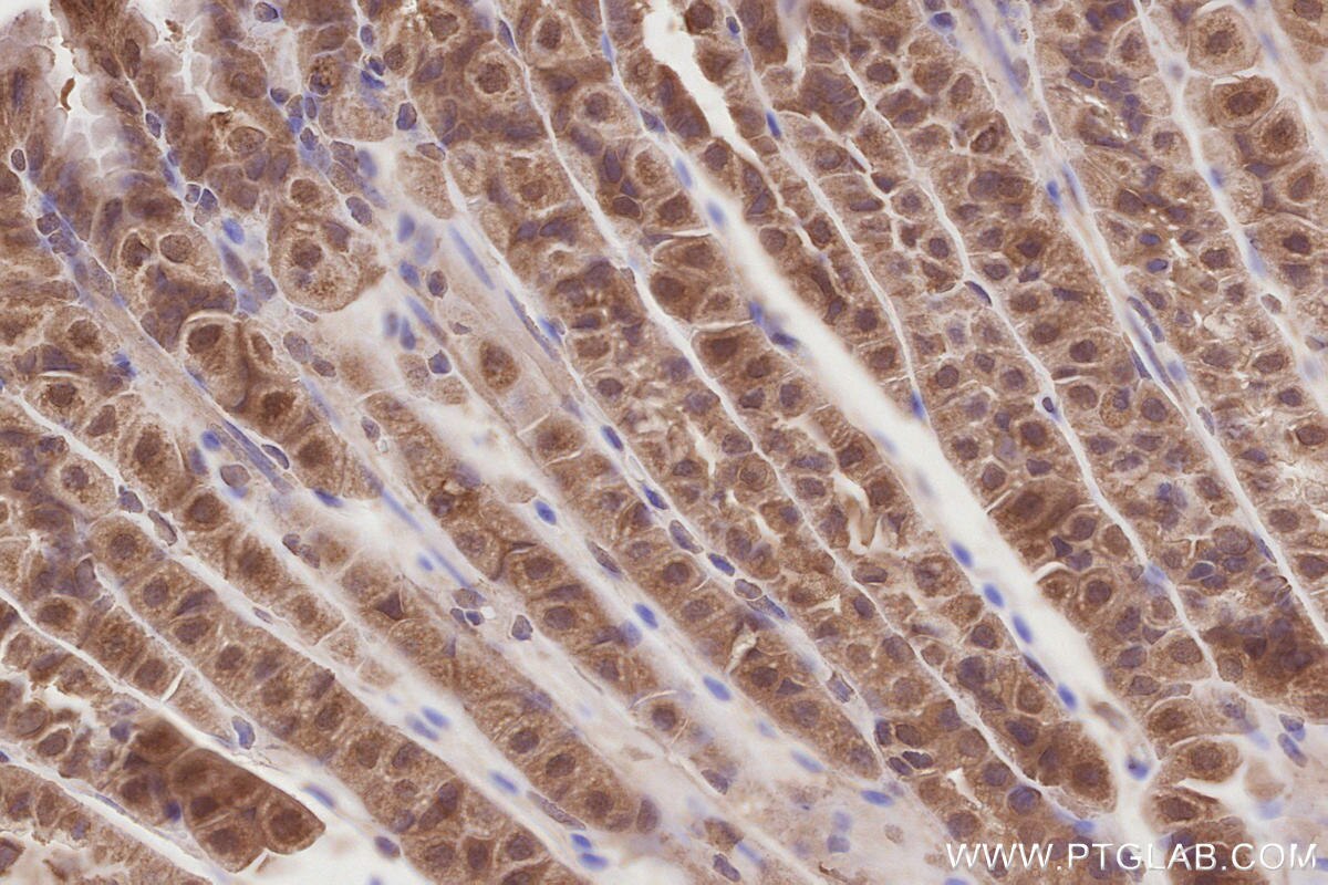 Immunohistochemical analysis of paraffin-embedded mouse stomach tissue slide using KHC2873 (KATNB1 IHC Kit).