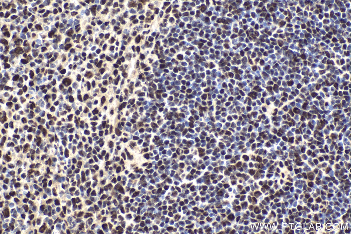 Immunohistochemical analysis of paraffin-embedded mouse spleen tissue slide using KHC1884 (KCTD15 IHC Kit).