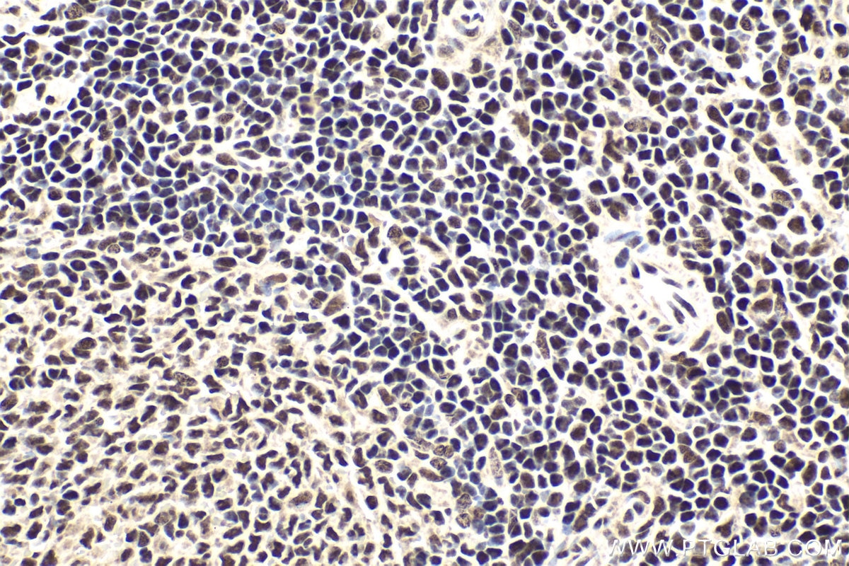 Immunohistochemical analysis of paraffin-embedded rat spleen tissue slide using KHC1884 (KCTD15 IHC Kit).