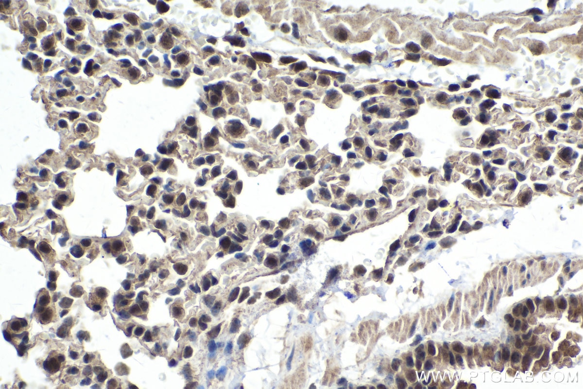 Immunohistochemical analysis of paraffin-embedded mouse lung tissue slide using KHC1465 (KDM1 IHC Kit).