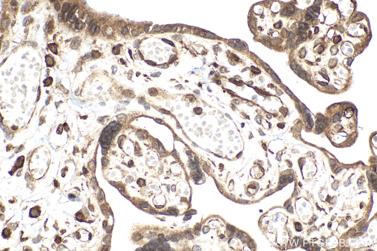 Immunohistochemical analysis of paraffin-embedded human placenta tissue slide using KHC2023 (KDM3A IHC Kit).