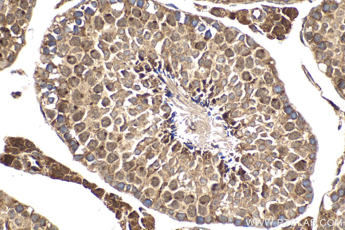 Immunohistochemical analysis of paraffin-embedded mouse testis tissue slide using KHC2023 (KDM3A IHC Kit).