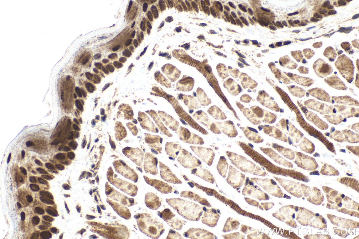 Immunohistochemical analysis of paraffin-embedded mouse tongue tissue slide using KHC2023 (KDM3A IHC Kit).