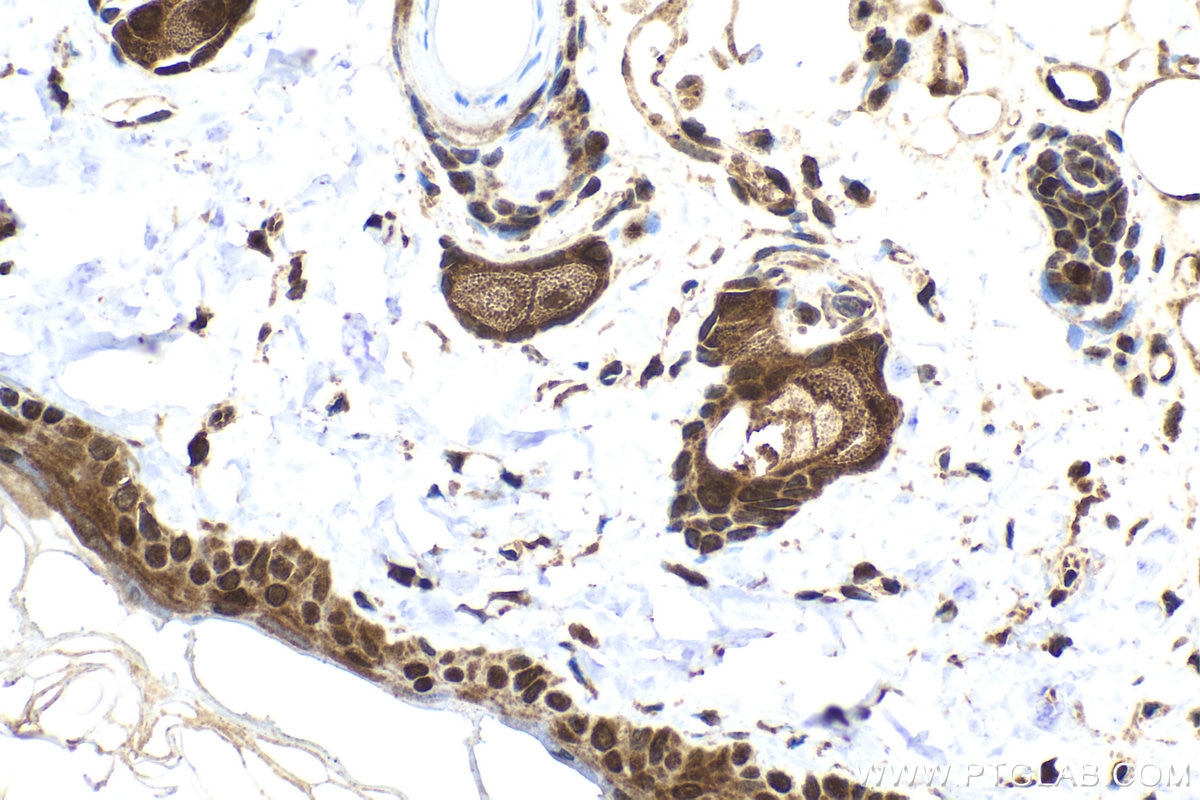 Immunohistochemical analysis of paraffin-embedded rat skin tissue slide using KHC2023 (KDM3A IHC Kit).