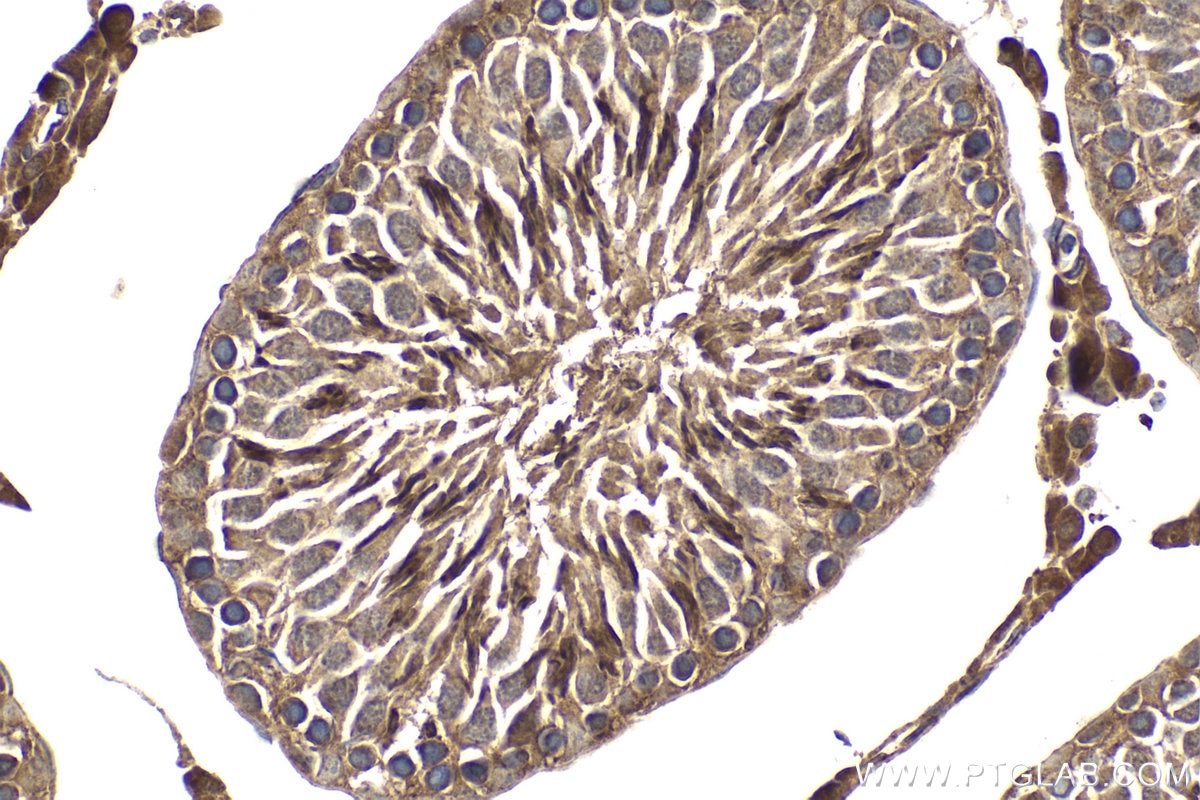 Immunohistochemical analysis of paraffin-embedded rat testis tissue slide using KHC2023 (KDM3A IHC Kit).