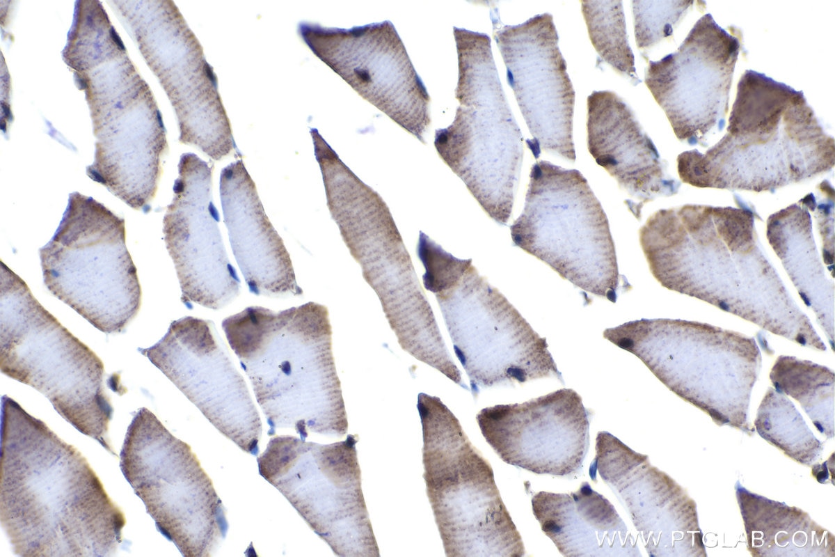 Immunohistochemical analysis of paraffin-embedded rat skeletal muscle tissue slide using KHC1064 (KEAP1 IHC Kit).