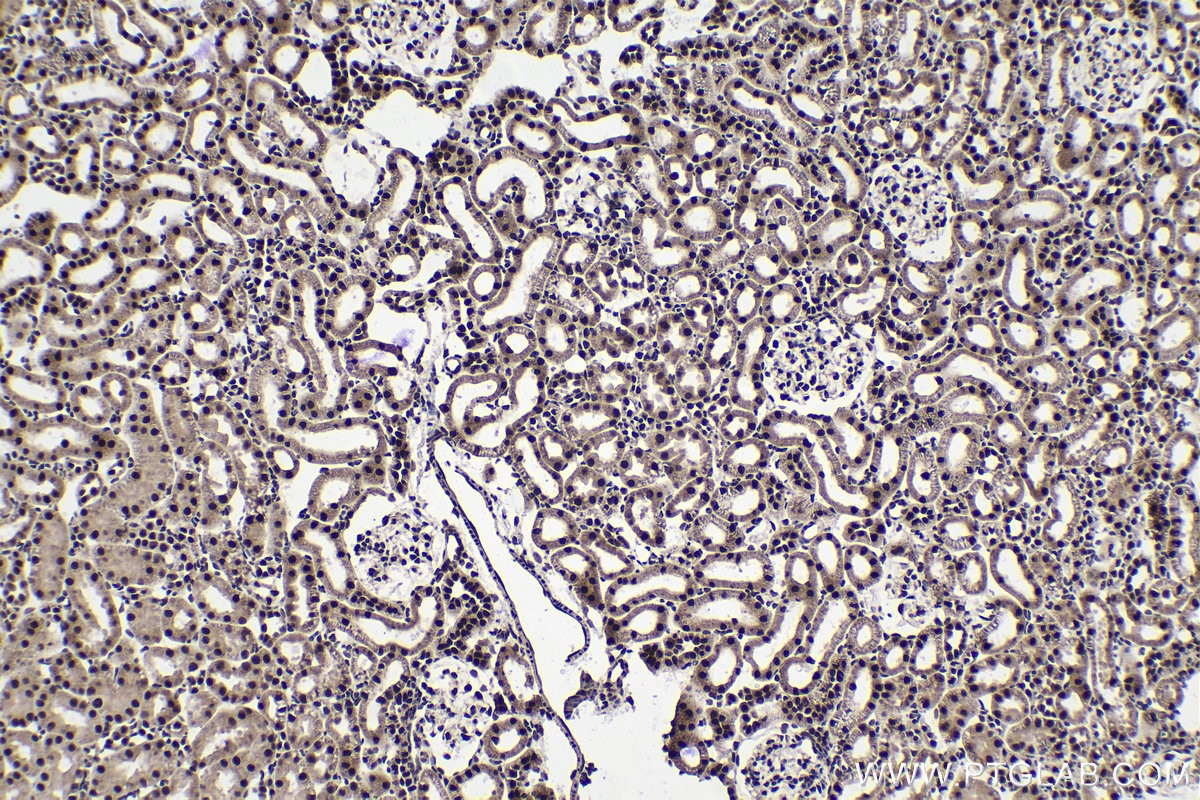 Immunohistochemical analysis of paraffin-embedded rat kidney tissue slide using KHC1391 (KHDRBS1 IHC Kit).