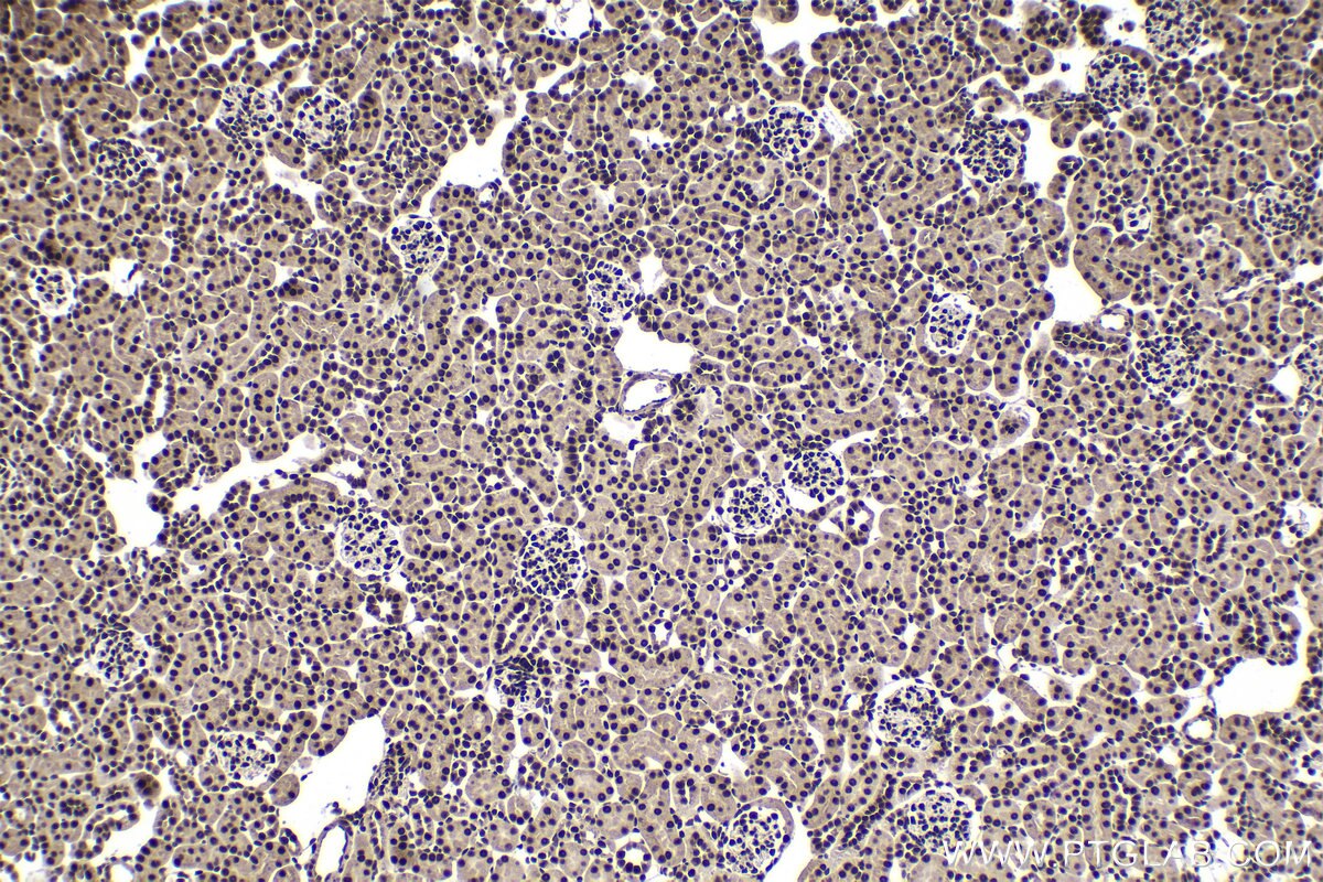Immunohistochemical analysis of paraffin-embedded mouse kidney tissue slide using KHC1391 (KHDRBS1 IHC Kit).