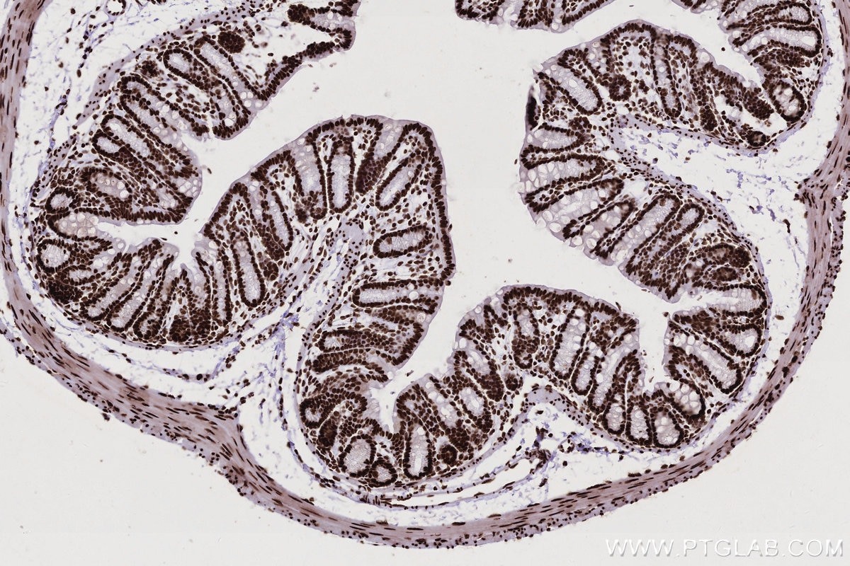 Immunohistochemical analysis of paraffin-embedded mouse colon tissue slide using KHC2767 (KHSRP IHC Kit).