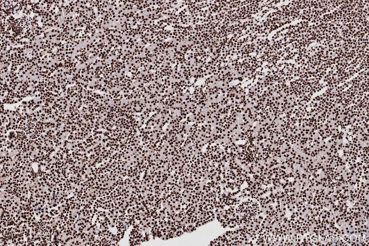 Immunohistochemical analysis of paraffin-embedded mouse kidney tissue slide using KHC2767 (KHSRP IHC Kit).