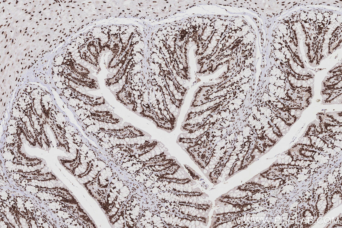 Immunohistochemical analysis of paraffin-embedded rat colon tissue slide using KHC2767 (KHSRP IHC Kit).